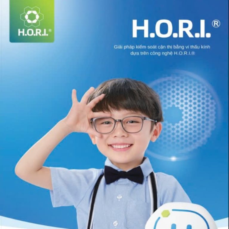 trong-kinh-kiem-soat-can-thi-hori